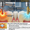 Do Gold Diamond Burs Really Reduce Heat? The Science